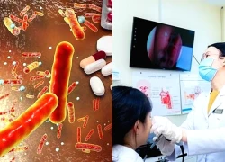 Kháng kháng sinh: 2 sai lầm 'chết người' về việc tự ý dùng thuốc và ca bệnh phải thở máy