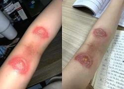 Người dân TP.HCM khổ sở vì kiến ba khoang