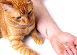 Người phụ nữ vào viện sau 5 giờ bôi nước chanh chữa mèo cắn