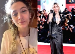 Con gái Michael Jackson bị hỏng mũi do lạm dụng ma túy