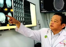 Đầu trẻ bị méo, dẹt: Cảnh báo trẻ sơ sinh dính khớp sọ!