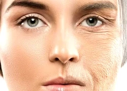 Kem chống nắng - tấm lá chắn chống lão hóa mùa hanh khô