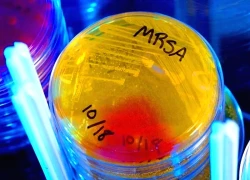 Phát hiện kháng sinh mạnh gấp 100 lần, mang hy vọng mới cho y học