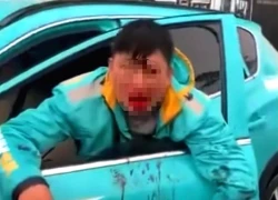 Điều tra vụ tài xế xe ôm công nghệ bị đánh chảy máu mồm ở Hà Nội