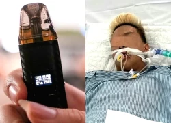 Suy thận, mắc phổi tắc nghẽn mãn tính vì hút thuốc lá điện tử