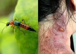 Con vật bé bằng hạt thóc có độc tố mạnh gấp 15 lần nọc rắn hổ mang