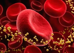 Đột phá trong điều trị rối loạn mỡ máu