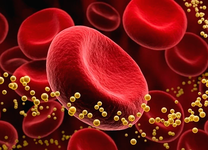 Đột phá trong điều trị rối loạn mỡ máu