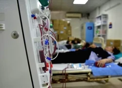 3 vị trí thâm đen trên người có thể là dấu hiệu bệnh thận