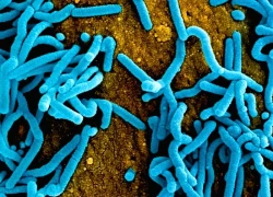 Ethiopia xác nhận 3 ca tử vong do virus Marburg