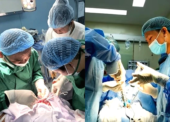 Người đàn ông mắc bệnh hiếm gặp với 'làn khói ' bỗng sinh ra trong não