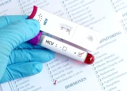 Những người cần đi khám gan sớm và thường xuyên