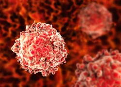 Vi khuẩn trong khối u não có thể đóng vai trò bất ngờ trong sự phát triển ung thư