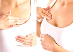 Cách kiểm tra phát hiện ung thư vú giai đoạn sớm