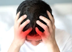 Nguyên nhân gây xuất huyết não