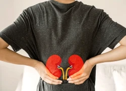 Những dấu hiệu cảnh báo suy thận dễ nhận biết nhưng ít người chú ý