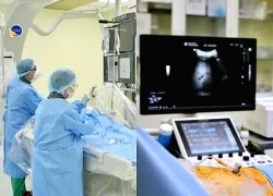 Ứng dụng công nghệ trong điều trị ít xâm lấn các ca u gan