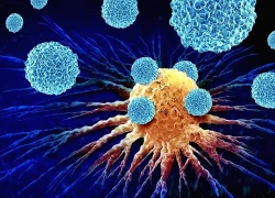 7 thói quen giúp bạn tránh xa ung thư