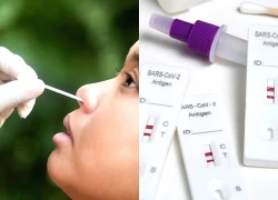 Cách test cúm A thế nào?