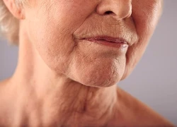 Khô miệng ở người cao tuổi, làm gì để cải thiện?