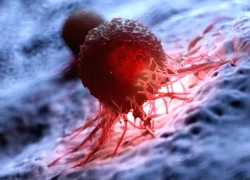 Phát hiện 'công tắc ẩn' khiến khối u kháng điều trị ung thư