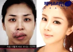 Cô gái vô danh khiến cả showbiz sững sờ với màn "vịt hoá thiên nga" thành mỹ nhân đẹp như búp bê