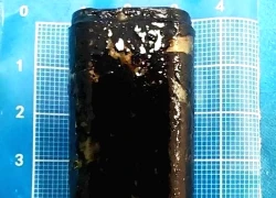 Người đàn ông Trung Quốc sống cùng bật lửa trong dạ dày suốt 30 năm