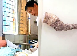 Dùng cây lạ chữa bệnh theo lời truyền miệng, 2 người suýt chết