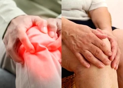 5 cách phòng tránh đau xương khớp mùa lạnh