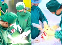 Ca mổ trong đêm khuya cứu sống sản phụ chửa ngoài tử cung vỡ, trụy mạch