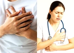 Ca nhồi máu cơ tim ở nữ nhân viên y tế 28 tuổi khiến bác sĩ ám ảnh