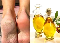 Cách khắc phục tình trạng da gót chân khô, nứt nẻ mùa đông
