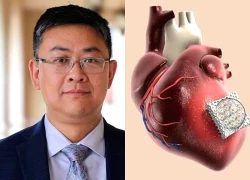 Phát minh miếng dán vi kim chữa lành và phục hồi tim do nhồi máu cơ tim