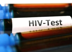 Hướng đi mới hứa hẹn chữa khỏi hẳn HIV