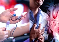 6 lưu ý cho bệnh nhân bị rối loạn đông máu tránh nguy cơ biến chứng