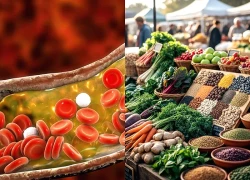 Bí quyết giảm Cholesterol: 5 nhóm thực phẩm 'vàng'