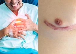 Cảnh báo khẩn: Bệnh tưởng của phụ nữ đang tấn công đàn ông Việt