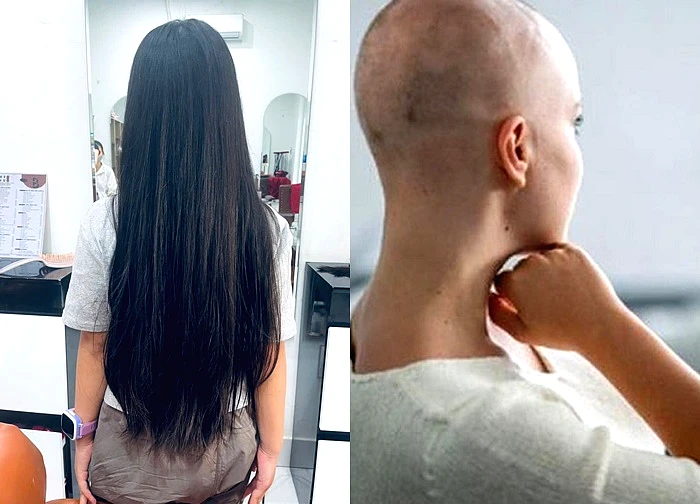 Chăm sóc khi tóc mọc lại ở bệnh nhân ung thư