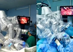 Phẫu thuật robot thay đổi đáng kể hiệu quả điều trị
