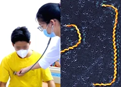 Tiếp xúc bùn đất ở khu cắm trại, chàng trai nhiễm xoắn khuẩn nguy hiểm