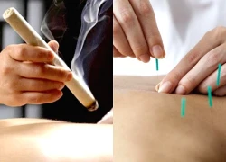 Ứng phó với đau xương khớp mùa lạnh bằng Y học cổ truyền