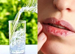 Môi khô không đơn thuần xuất phát từ thiếu ẩm như nhiều người vẫn nghĩ