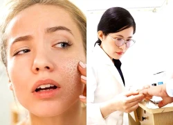 Chăm sóc da mùa hanh khô