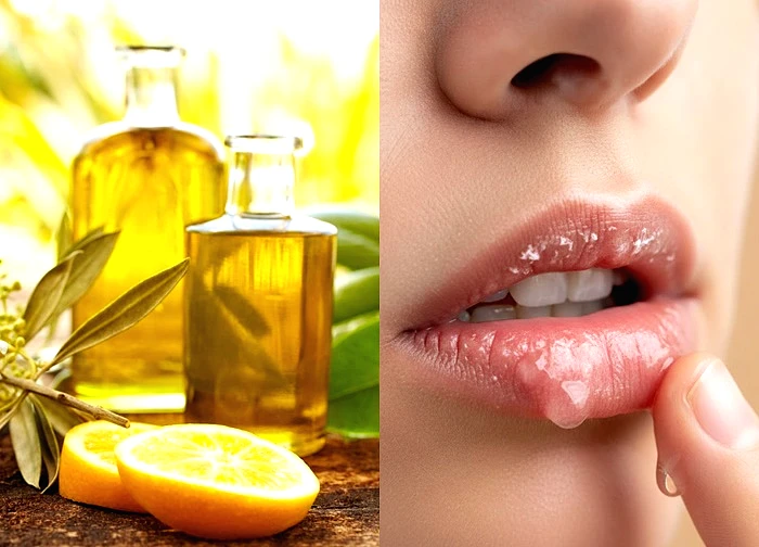 Gợi ý 8 biện pháp khắc phục tại nhà cho môi khô và nứt nẻ