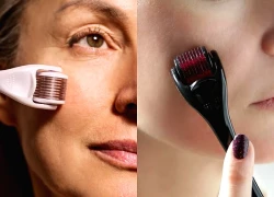 Lăn kim tại nhà có thực sự hiệu quả?