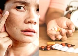 Mối liên hệ giữa corticoid và lão hóa sớm