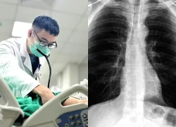 Phổi bị phá hủy, tiên lượng rất xấu vì căn bệnh tưởng nhẹ