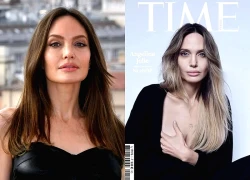 Angelina Jolie công khai vết sẹo cắt bỏ ngực