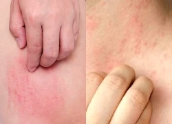 Con người có thể tiếp xúc 100.000 loại độc tố mỗi ngày