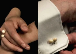 Cô gái chuyên thu mua răng người